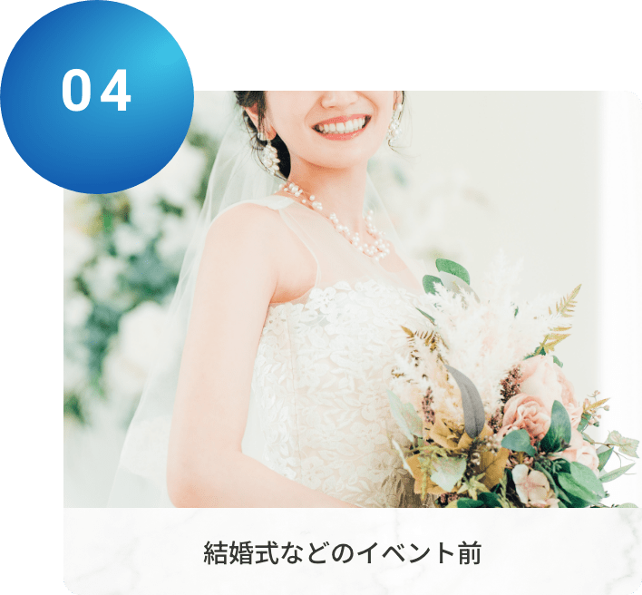 結婚式などのイベント前